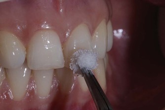 Pulp Testing in Malviya Nagar